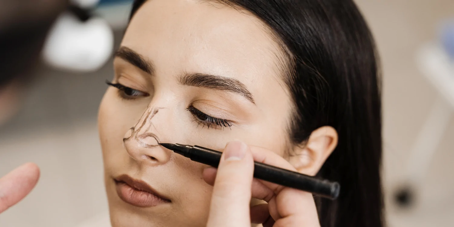 Thinking About Rhinoplasty? Everything Patients Want to Know Before a Nose Job