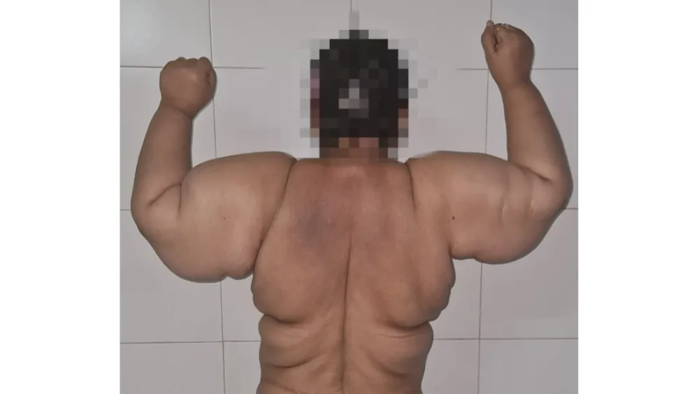 Before surgery