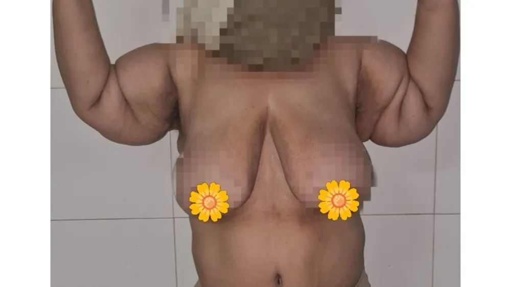 Before surgery