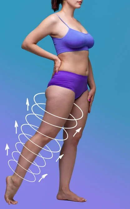 Medial Thigh Lift