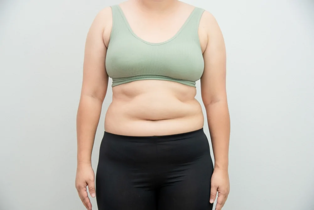 Morbid Obesity Correction — hero image