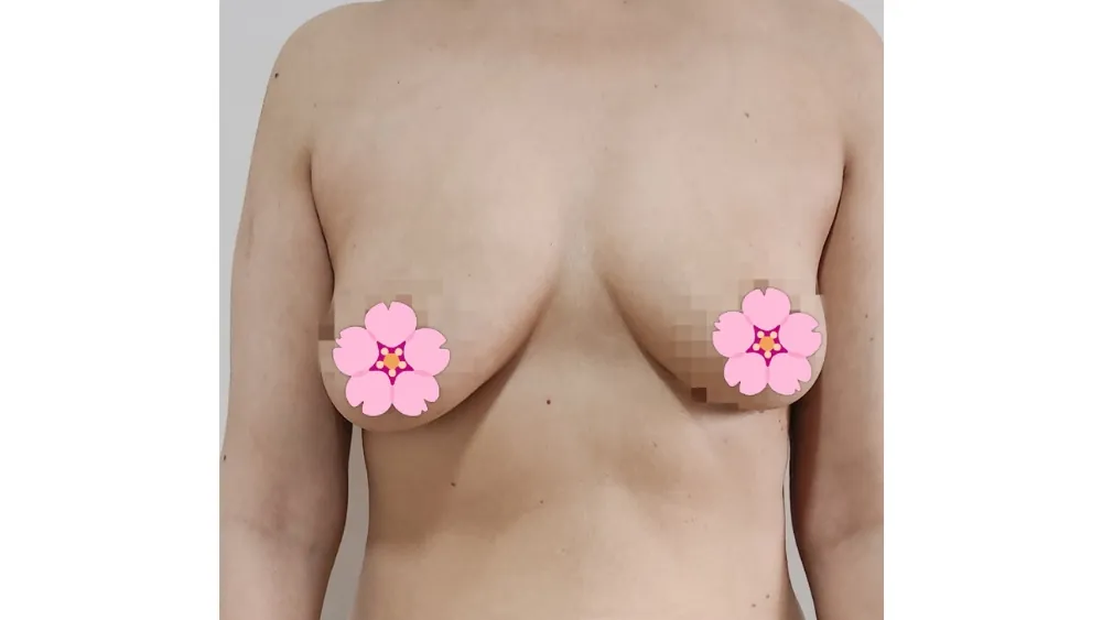 Before surgery