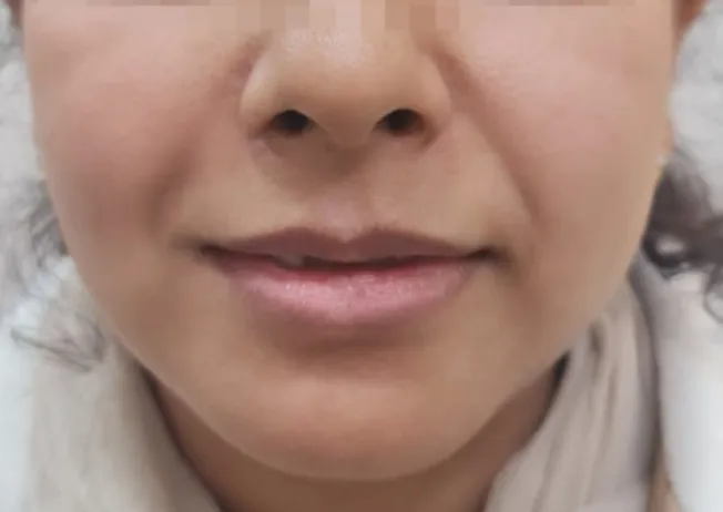 Before surgery