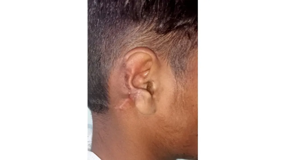 Before surgery