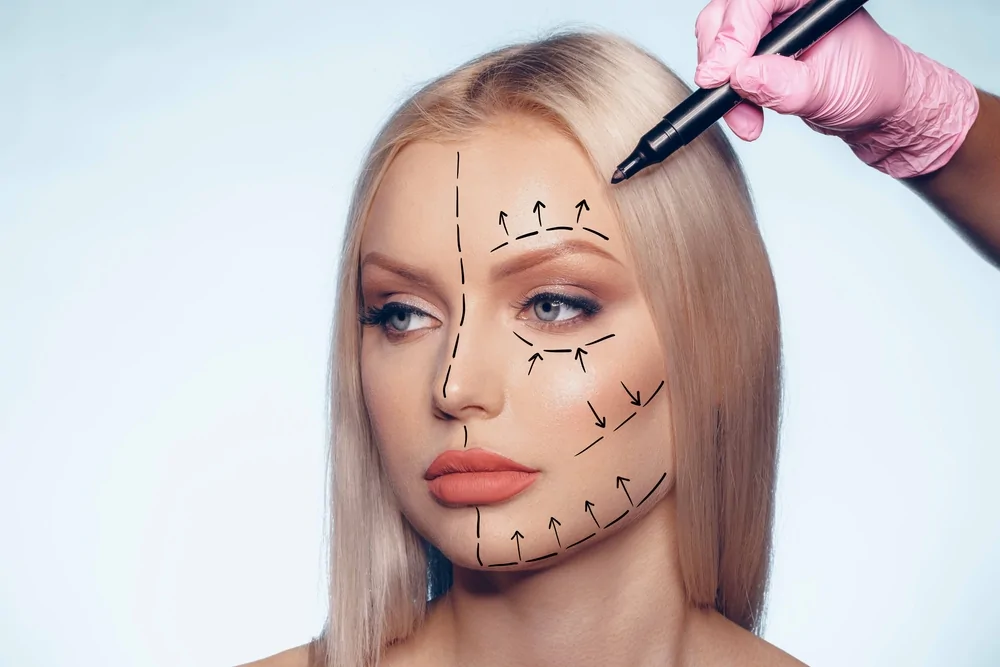 Correction of Facial Wrinkles — hero image
