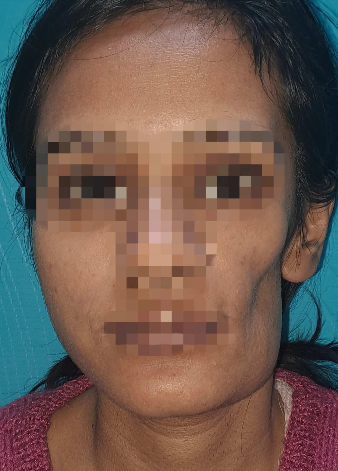 Before surgery