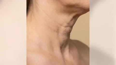 Before surgery