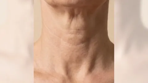 Before surgery