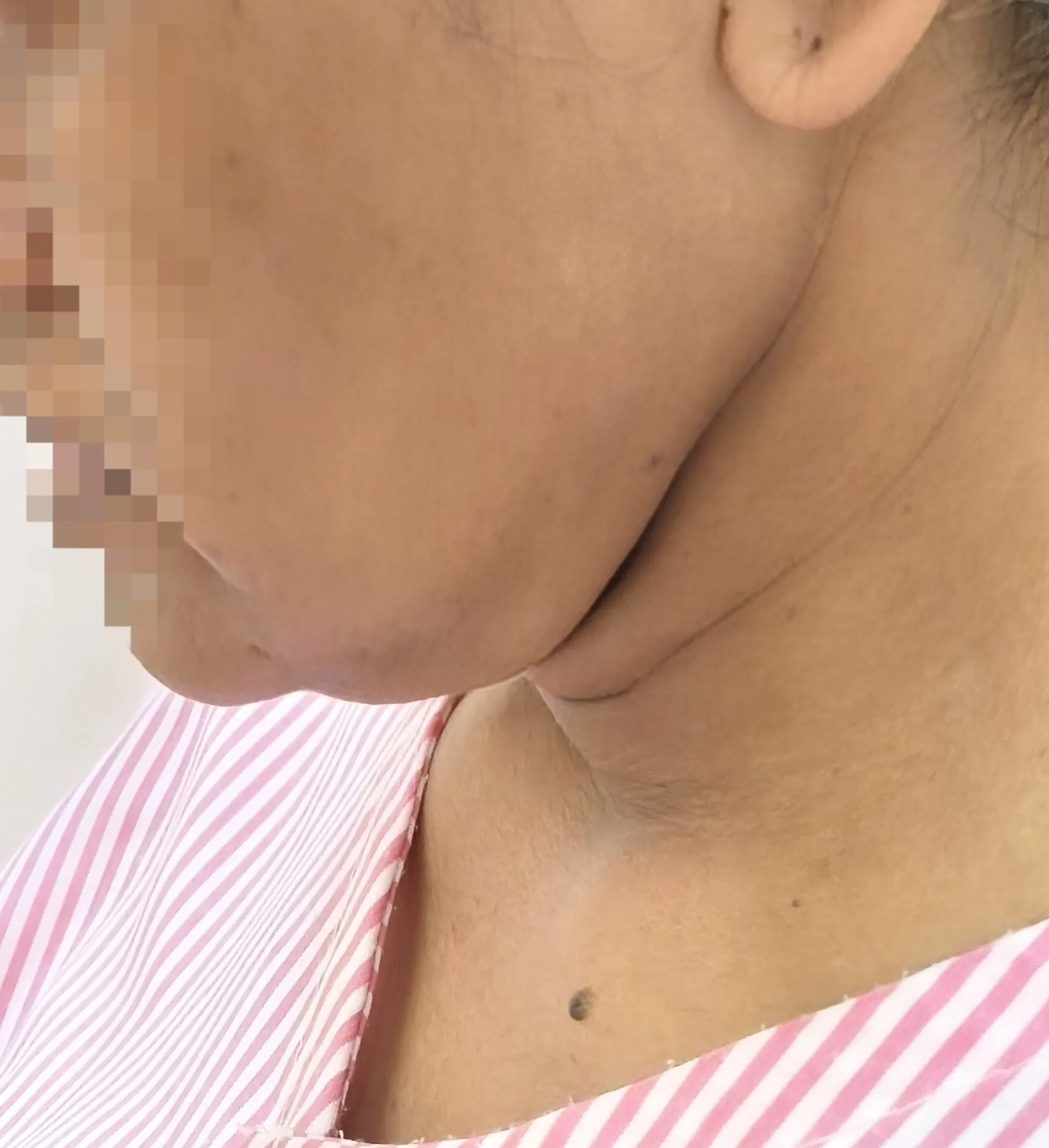Before surgery
