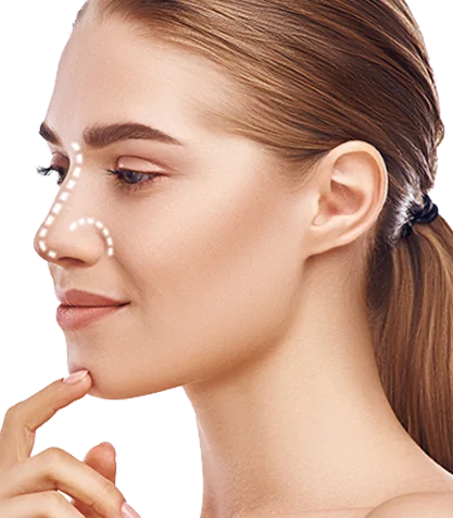 Rhinoplasty Surgery — procedure visual