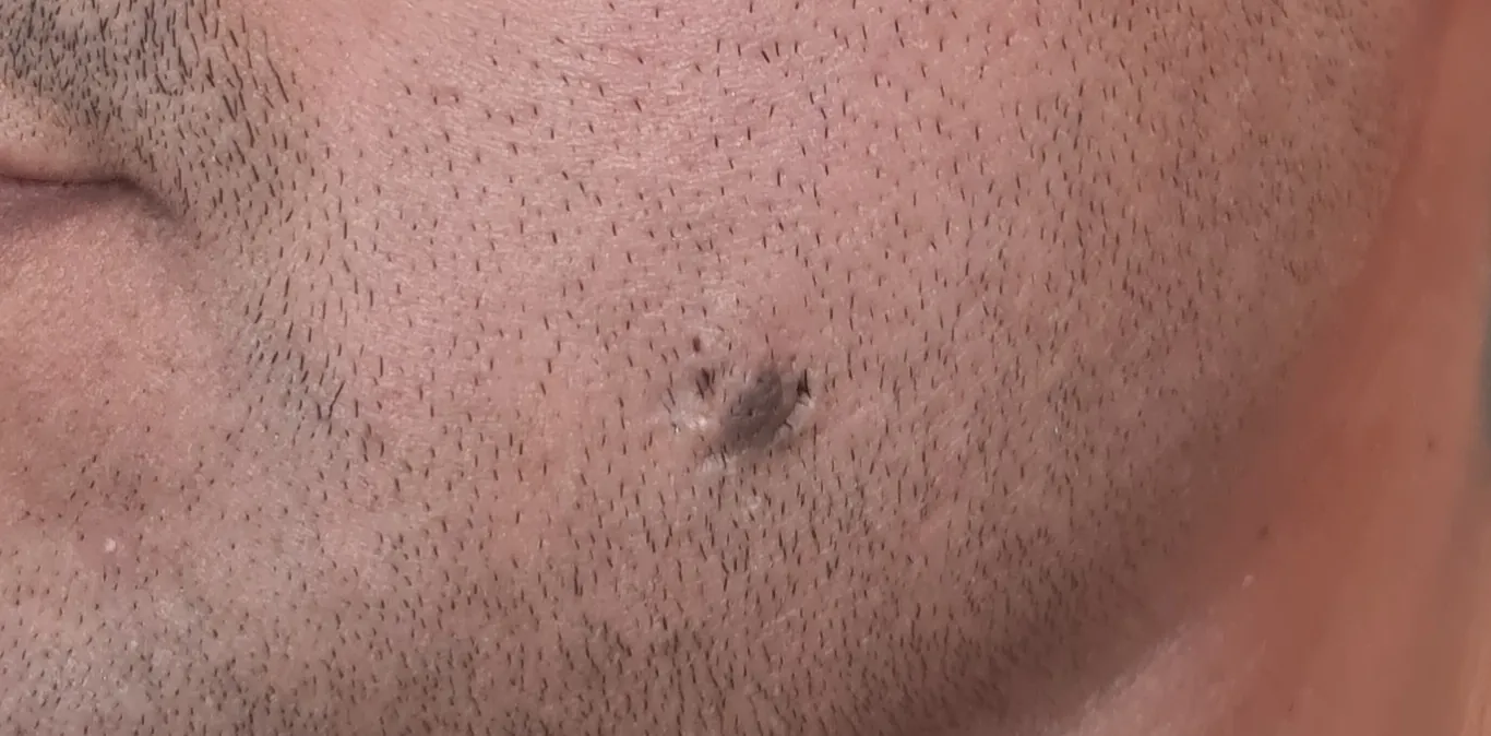 Before surgery