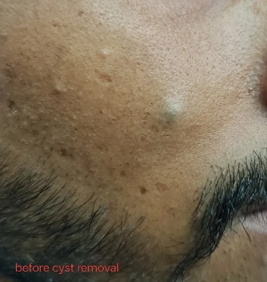 Before surgery