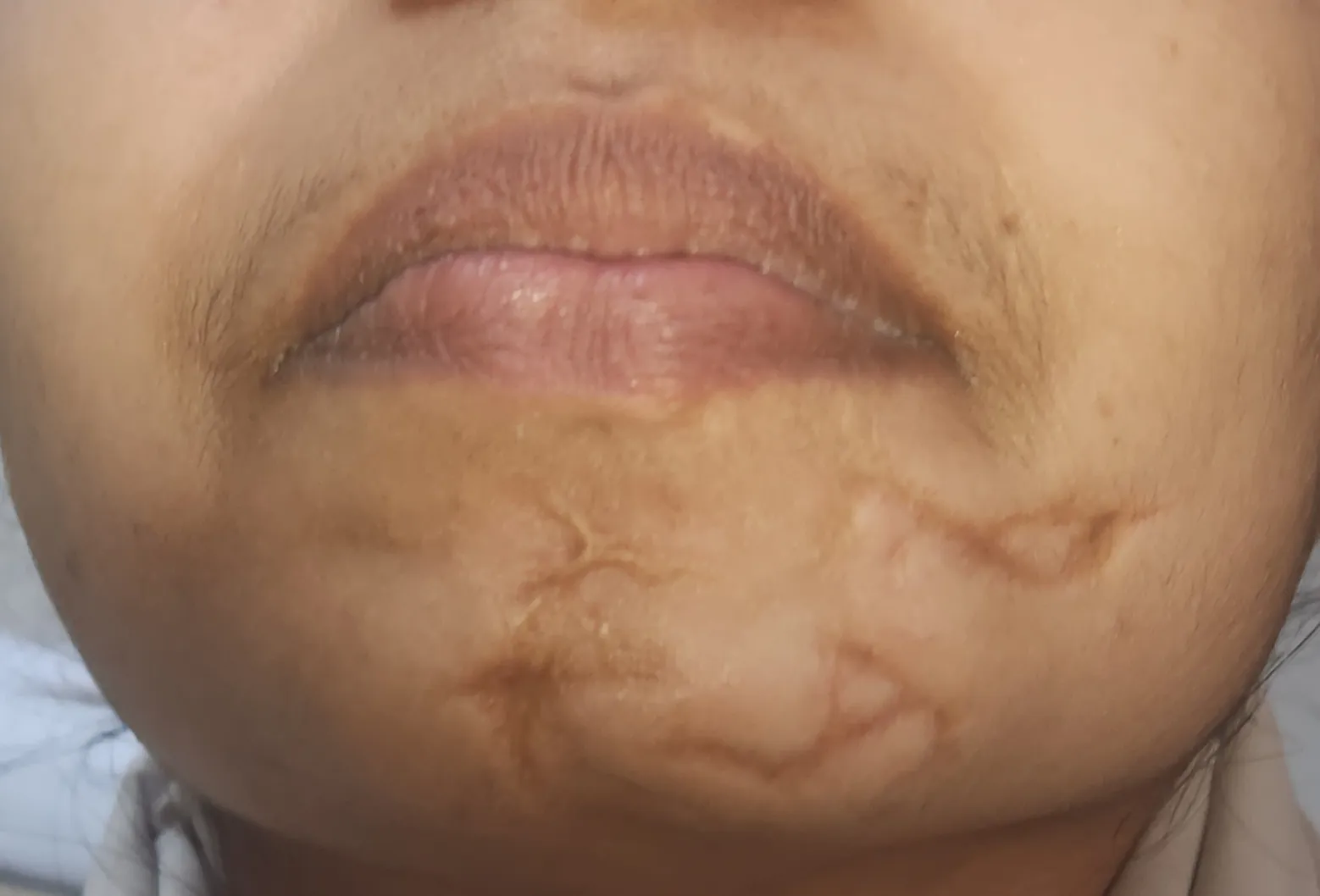 Before surgery