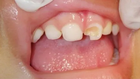 Before surgery