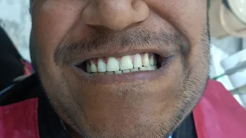 Cosmetic Dentistry — after