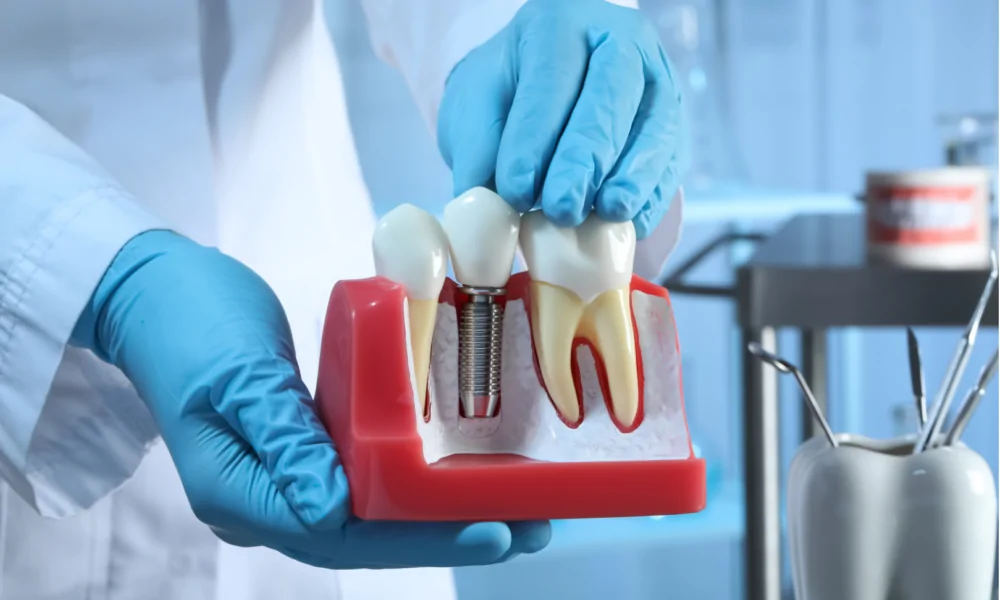 Cosmetic & Regular Dental Fillings — hero image