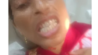 Emergency Dental Care — after