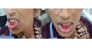Emergency Dental Care — before