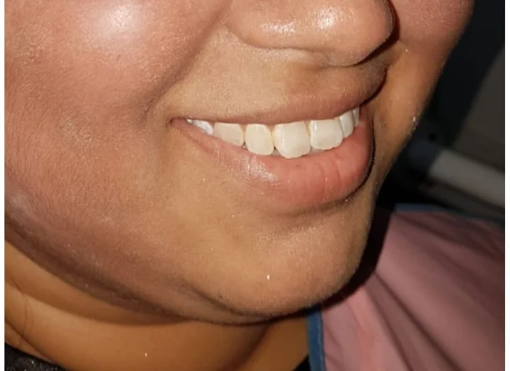 Orthodontics — before