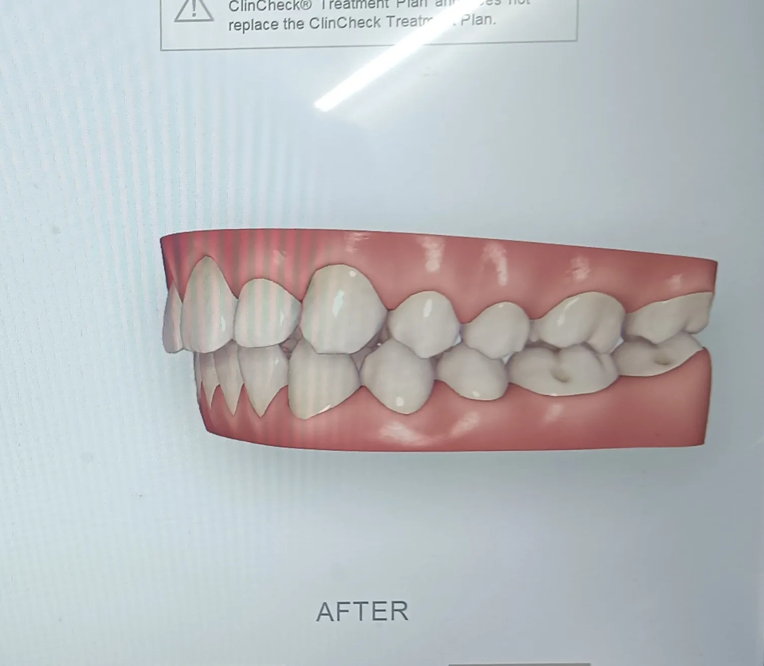 After surgery