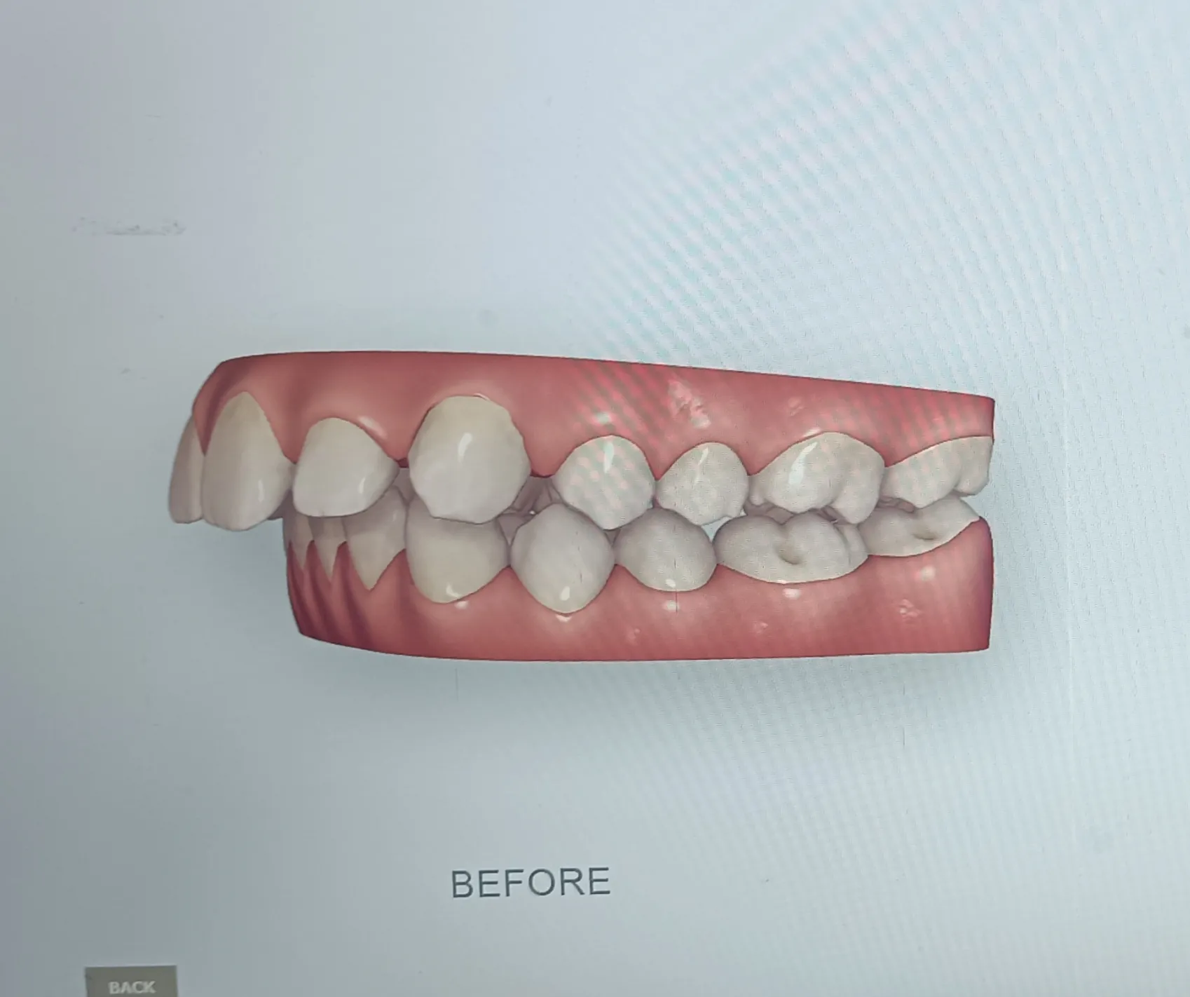 Before surgery