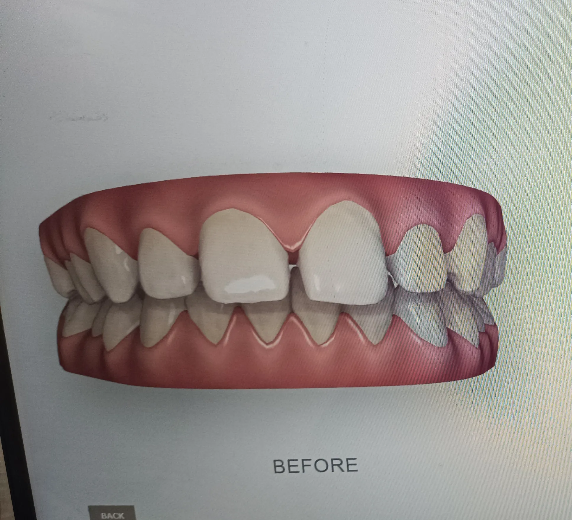 Before surgery