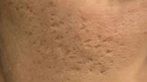 Before surgery