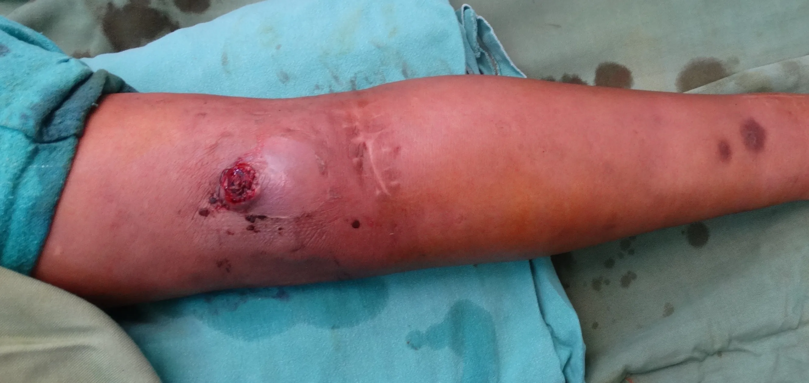Before surgery