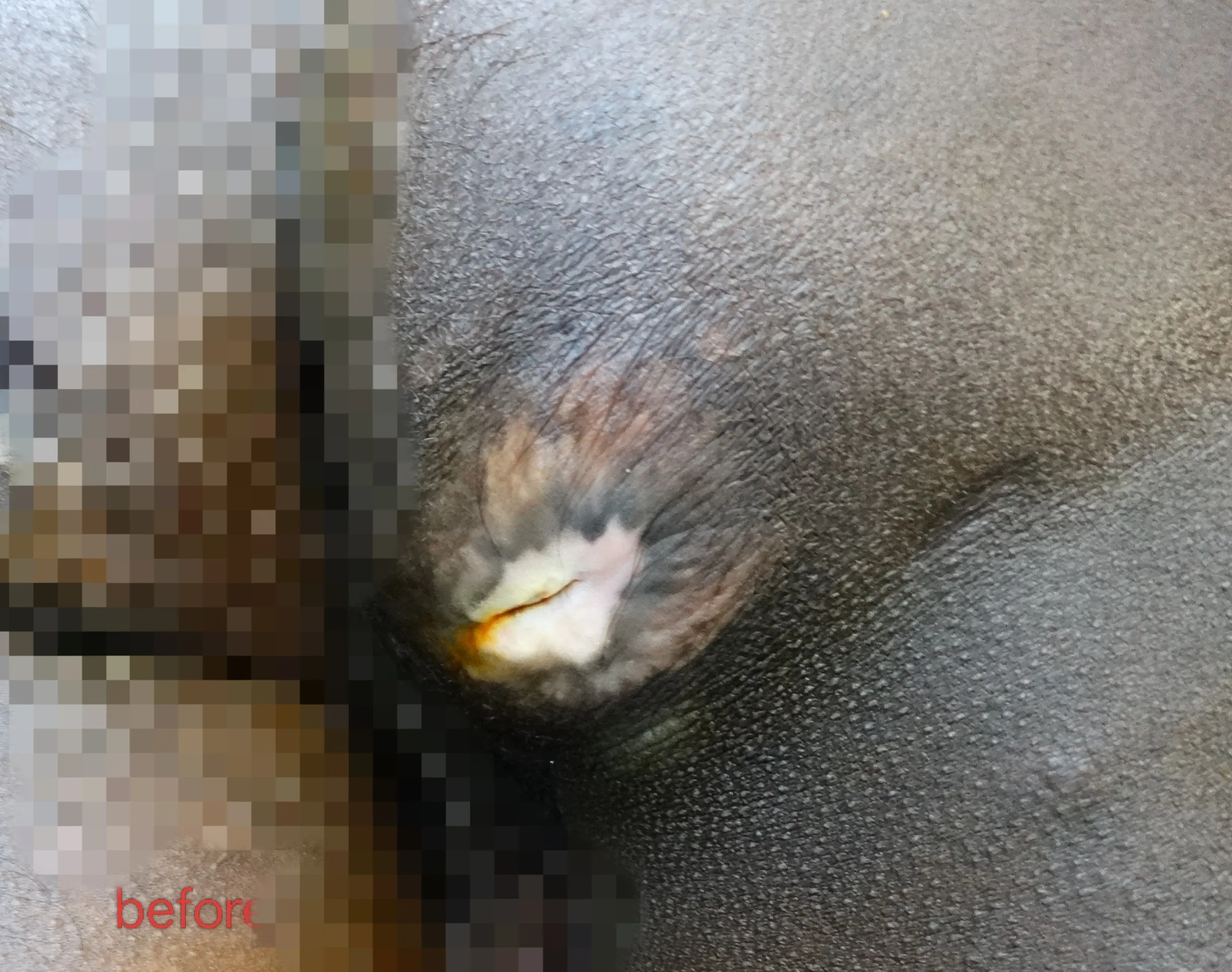 Before surgery