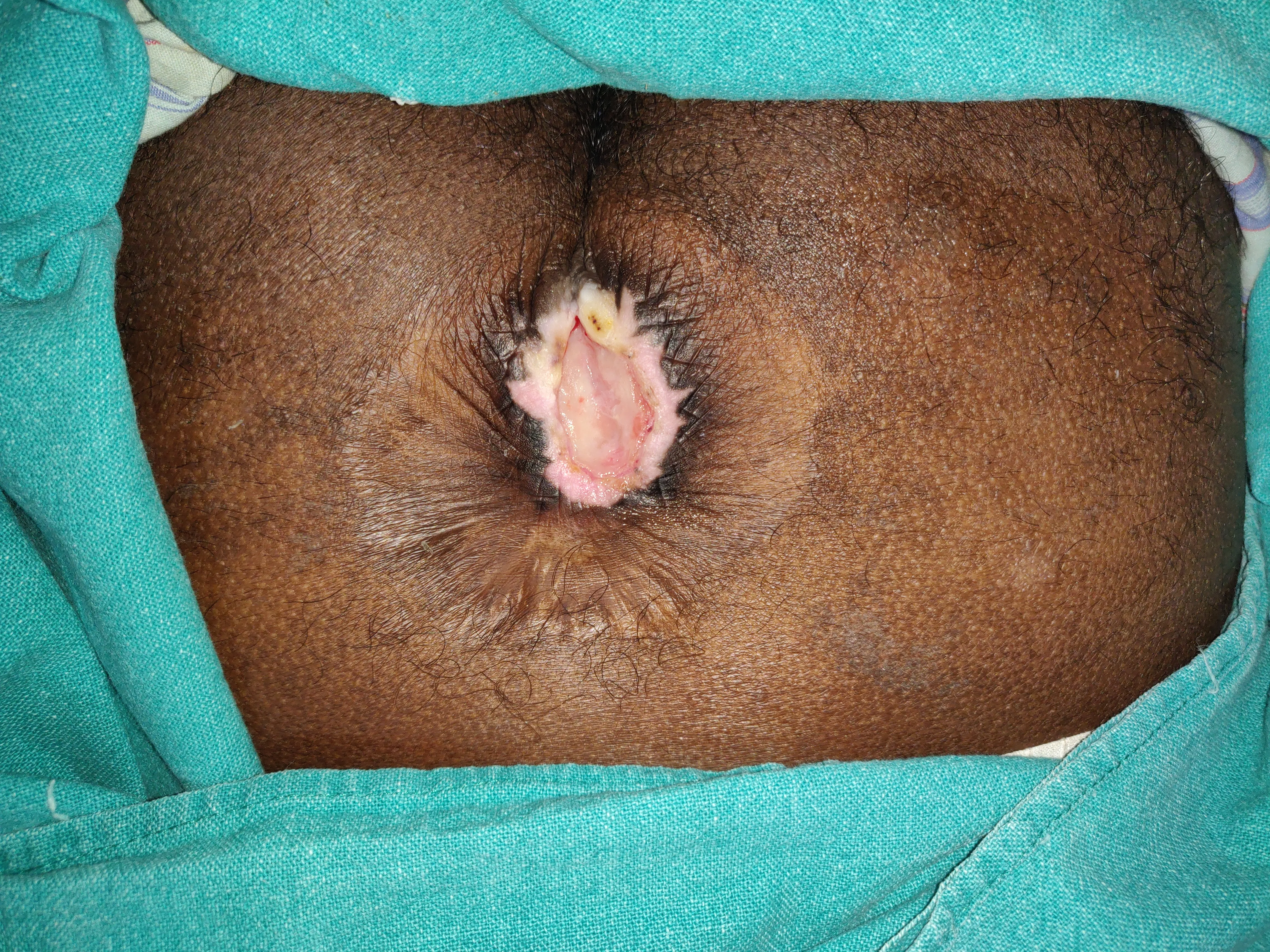 Before surgery