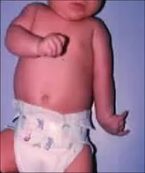 Before surgery