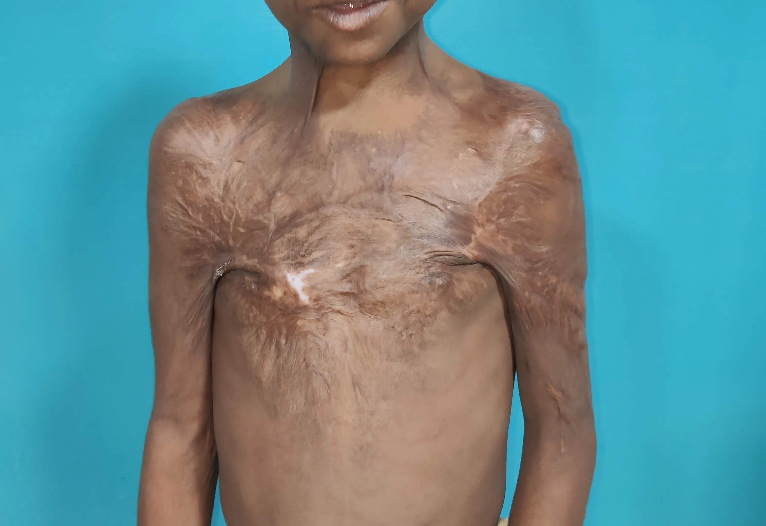 Before surgery