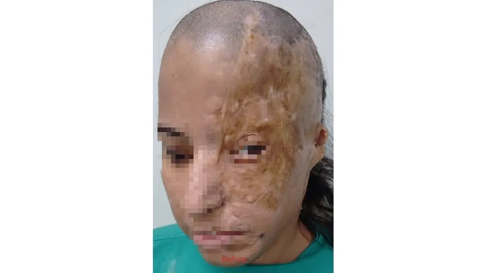 Before surgery