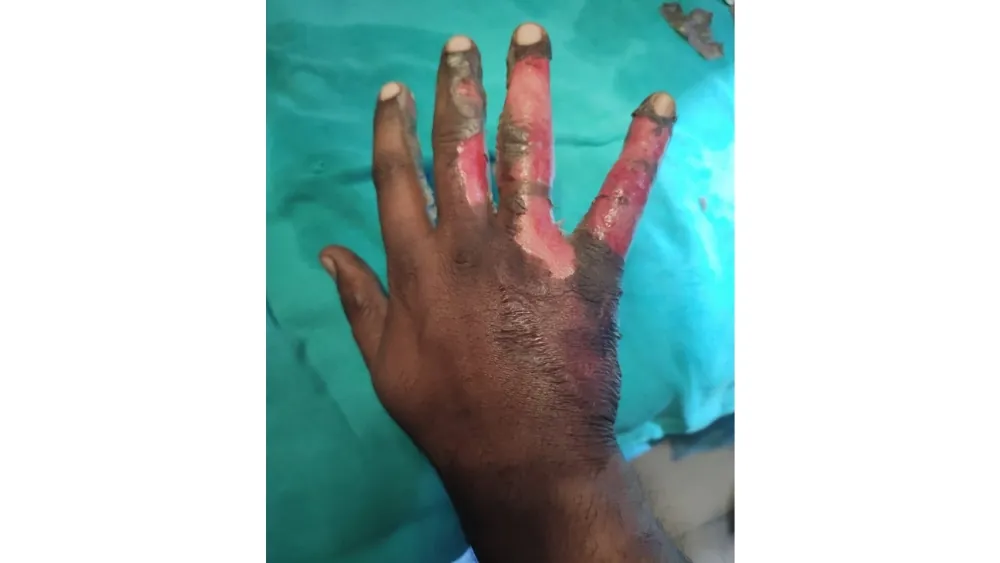 Before surgery