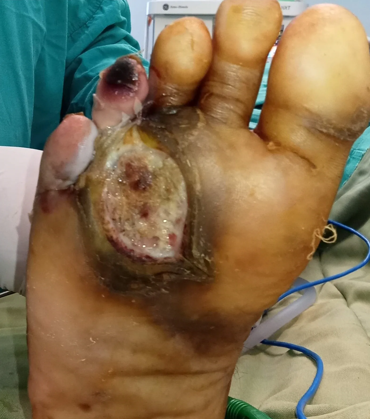 Before surgery