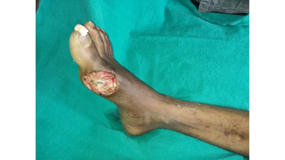 Before surgery