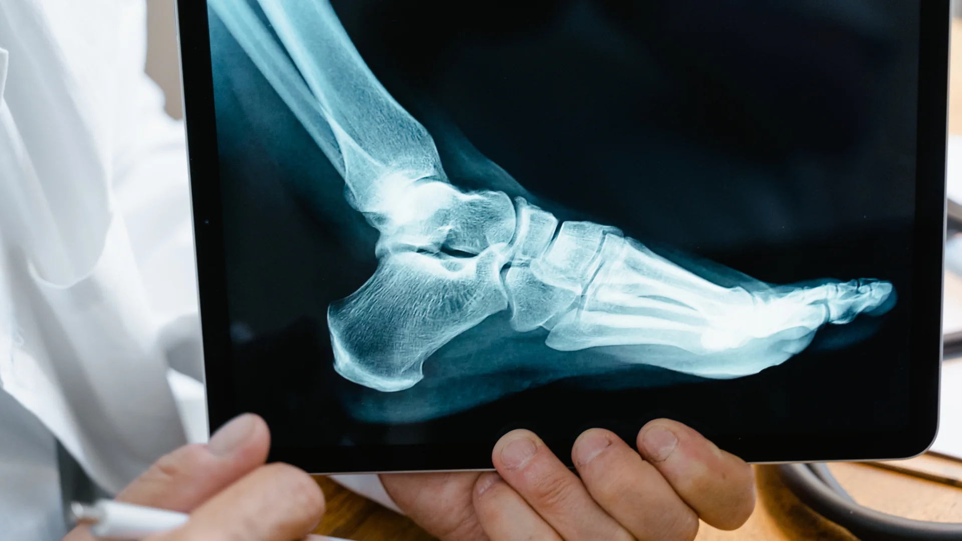 Diabetic Foot Surgery — hero image