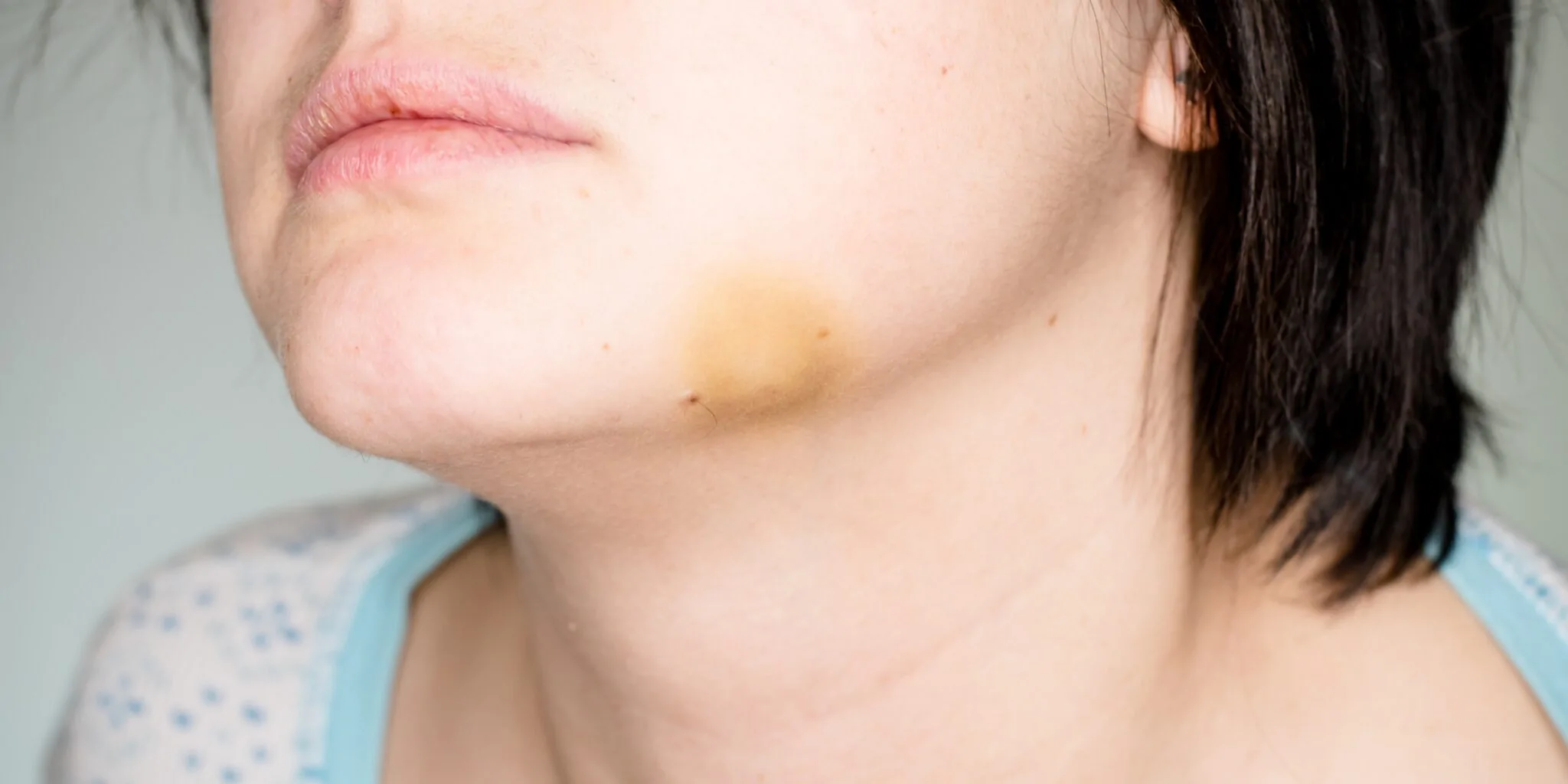 Face Injuries — hero image