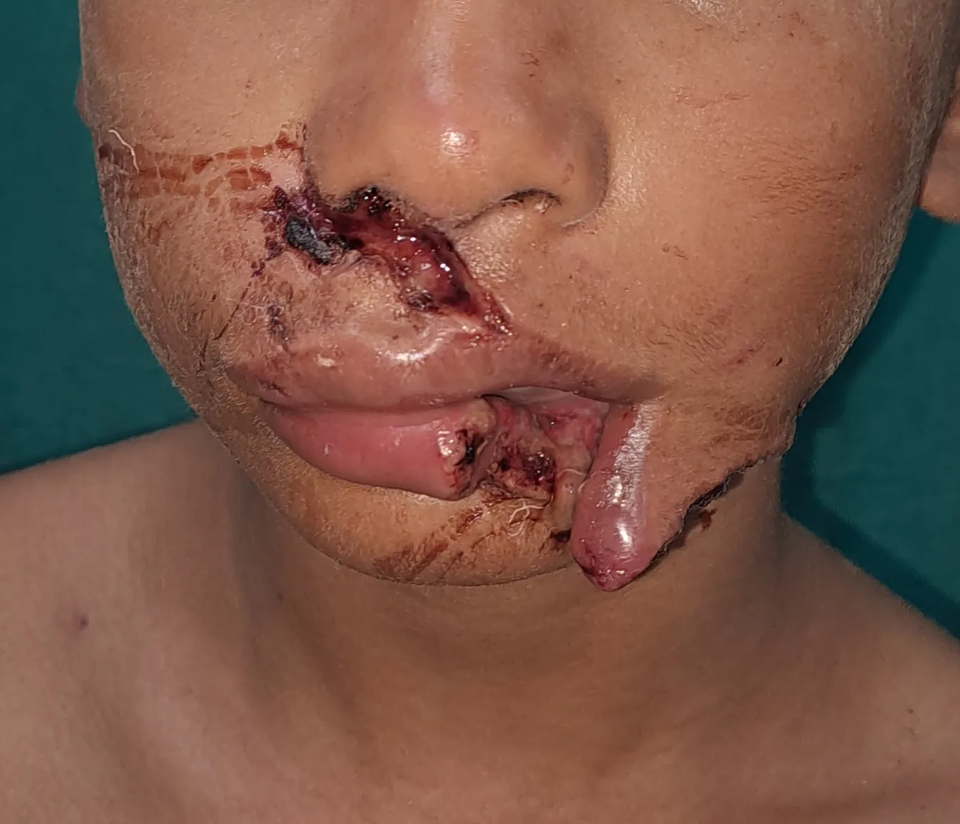 Before surgery