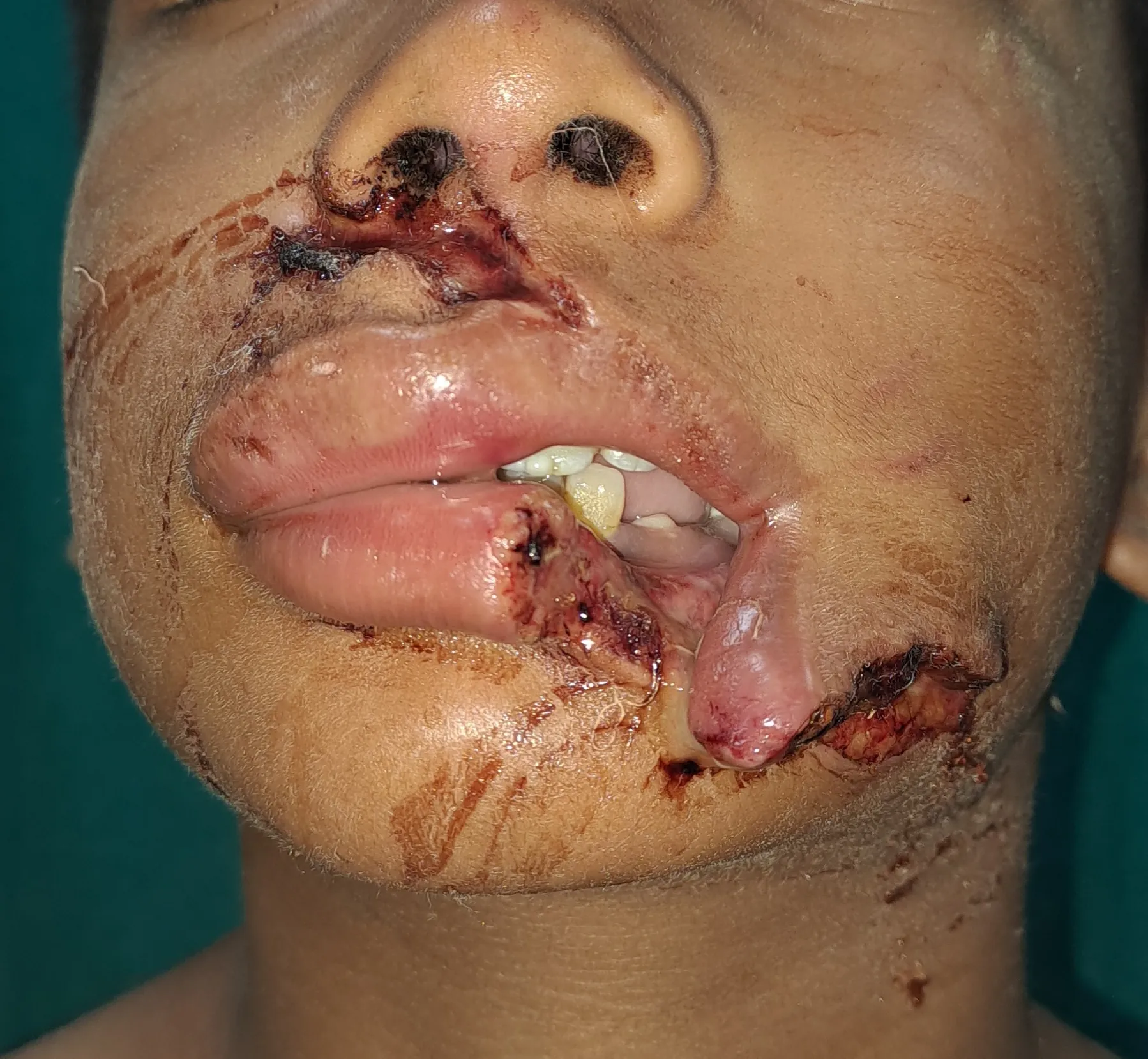 Before surgery