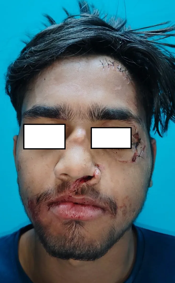 Before surgery