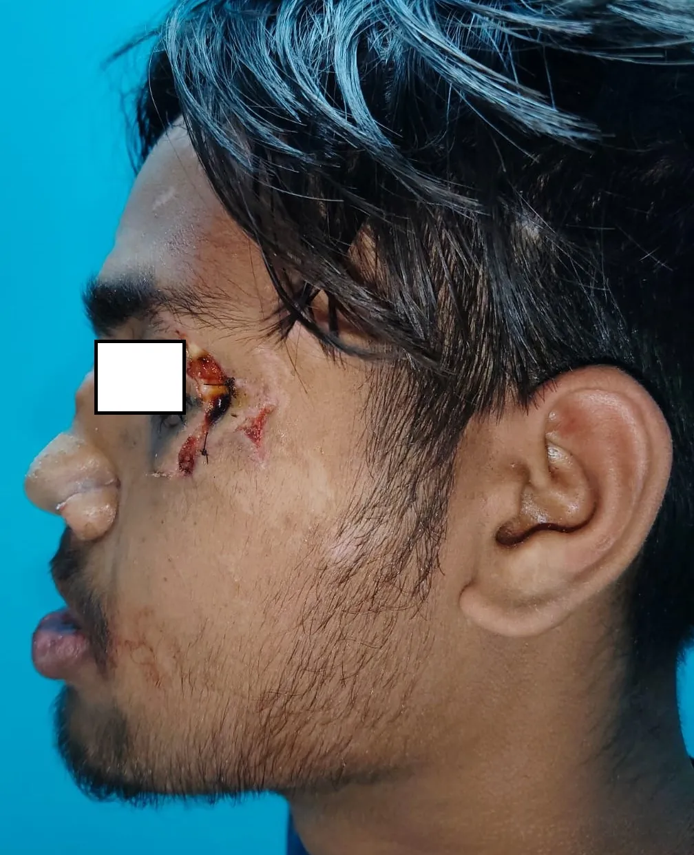 Before surgery