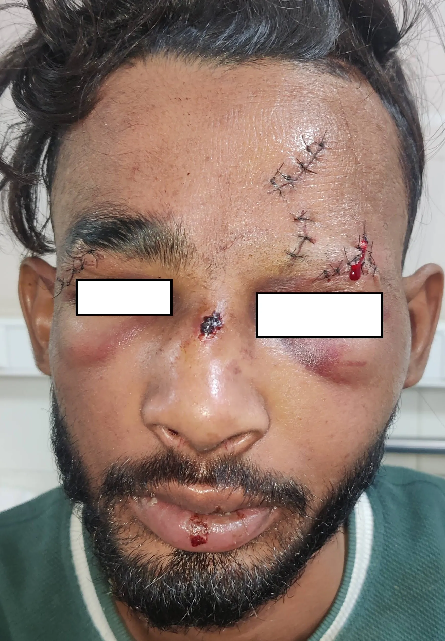 Before surgery