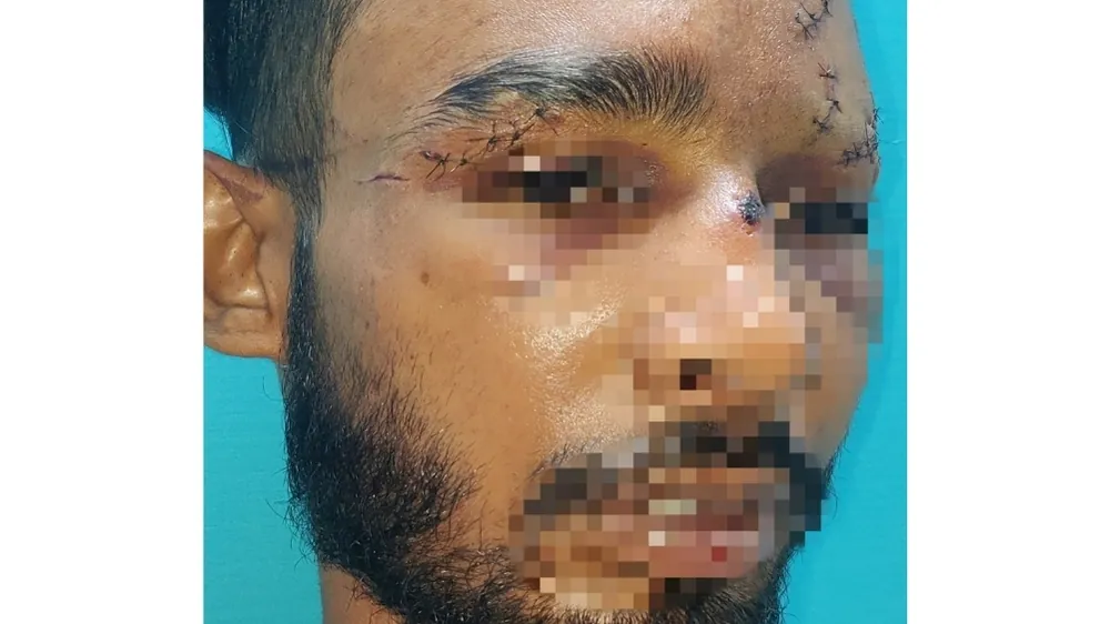 Before surgery