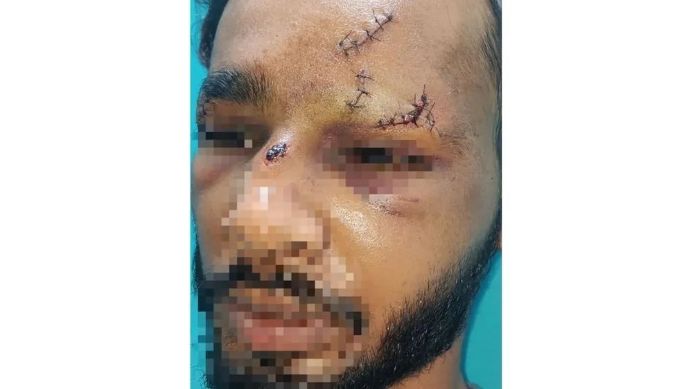 Before surgery