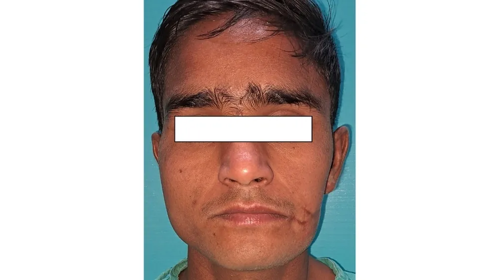 Before surgery