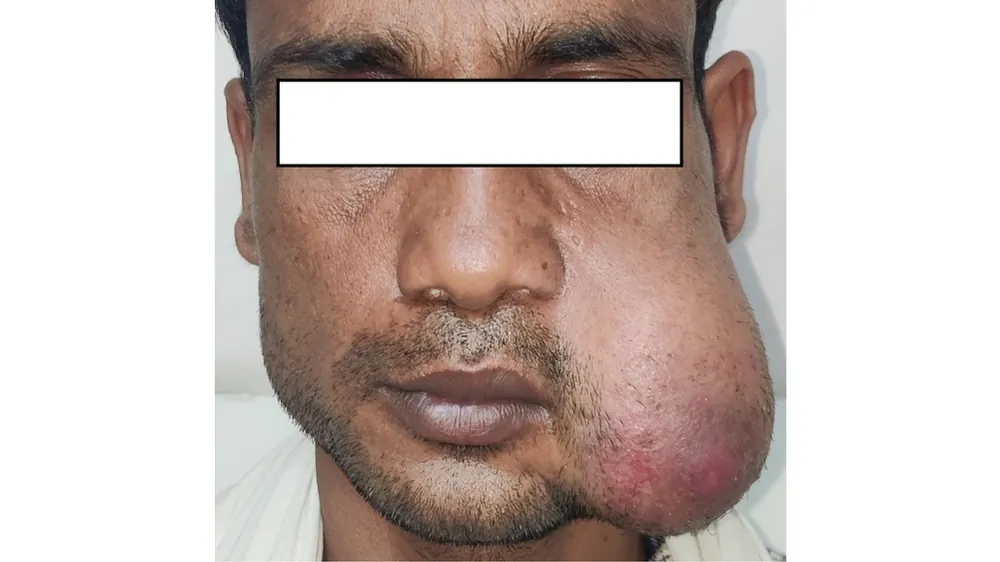 Before surgery