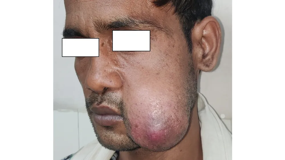 Before surgery