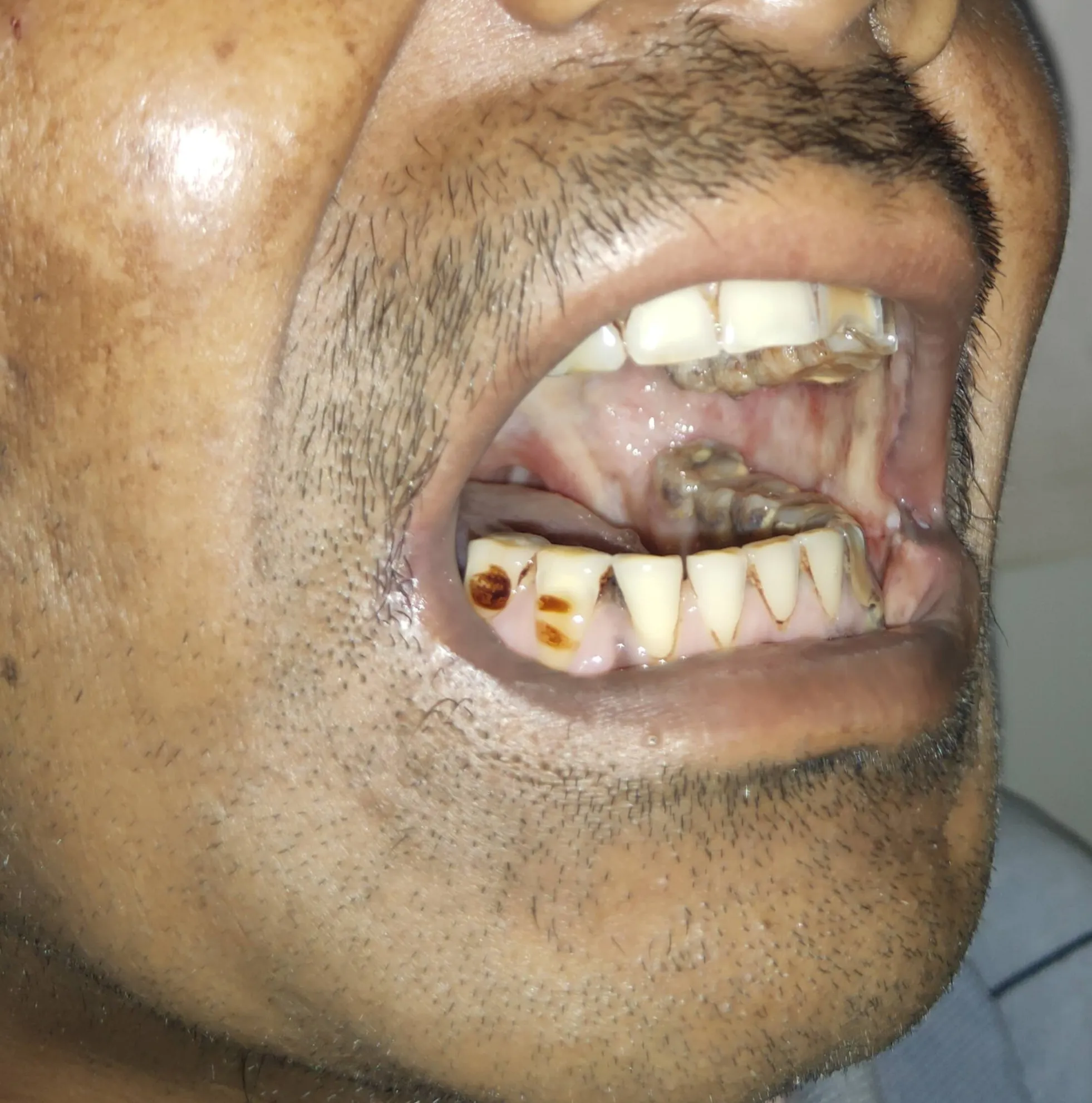 Before surgery