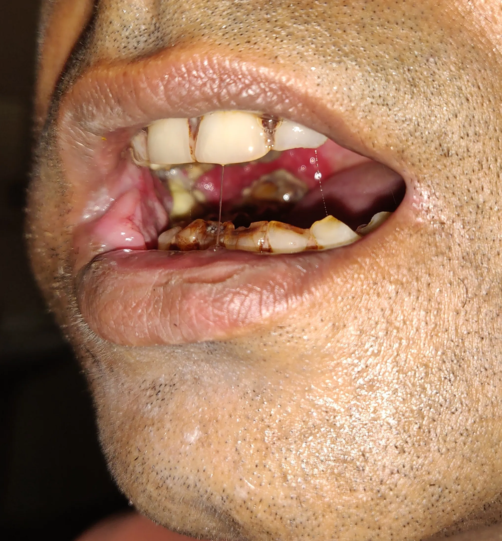 Before surgery